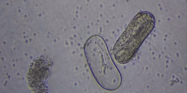 Plant parasitic nematodes under the microscope.